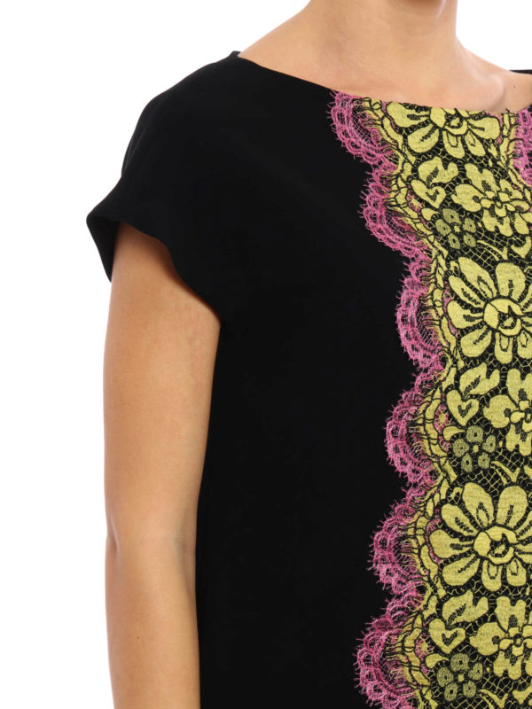Contrasting lace detail tunic dress 